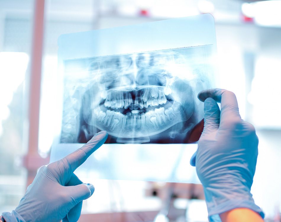 radiografia radiografia