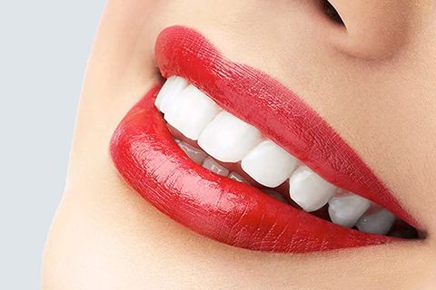 Estética dental en la Sagrera en Blaudent Estética dental en la Sagrera en Blaudent