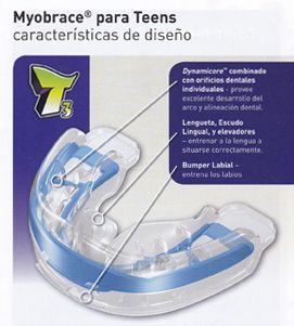 Ortodoncia sin brackets para Teens en la Sagrera Ortodoncia sin brackets para Teens en la Sagrera