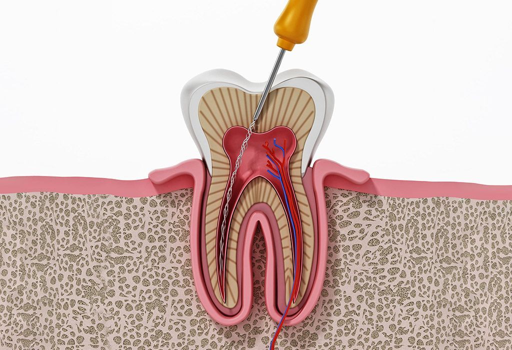 Odontología conservadora en La Sagrera Odontología conservadora en La Sagrera