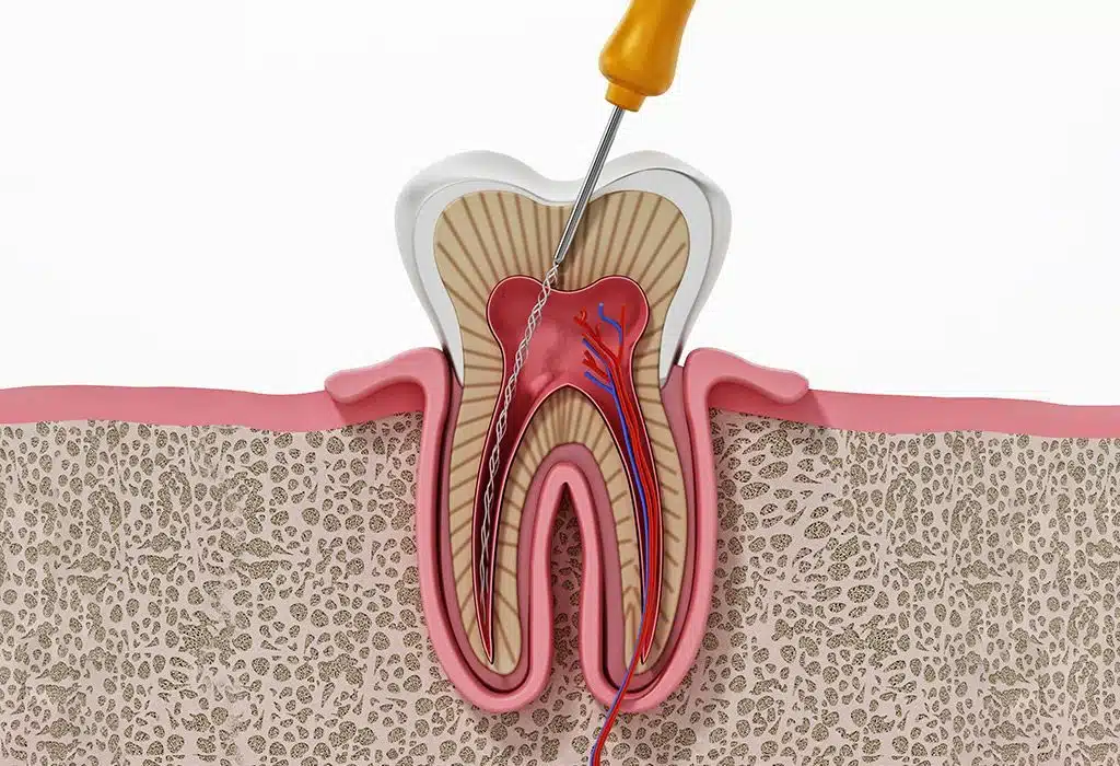 Odontología conservadora en La Sagrera Odontología conservadora en La Sagrera