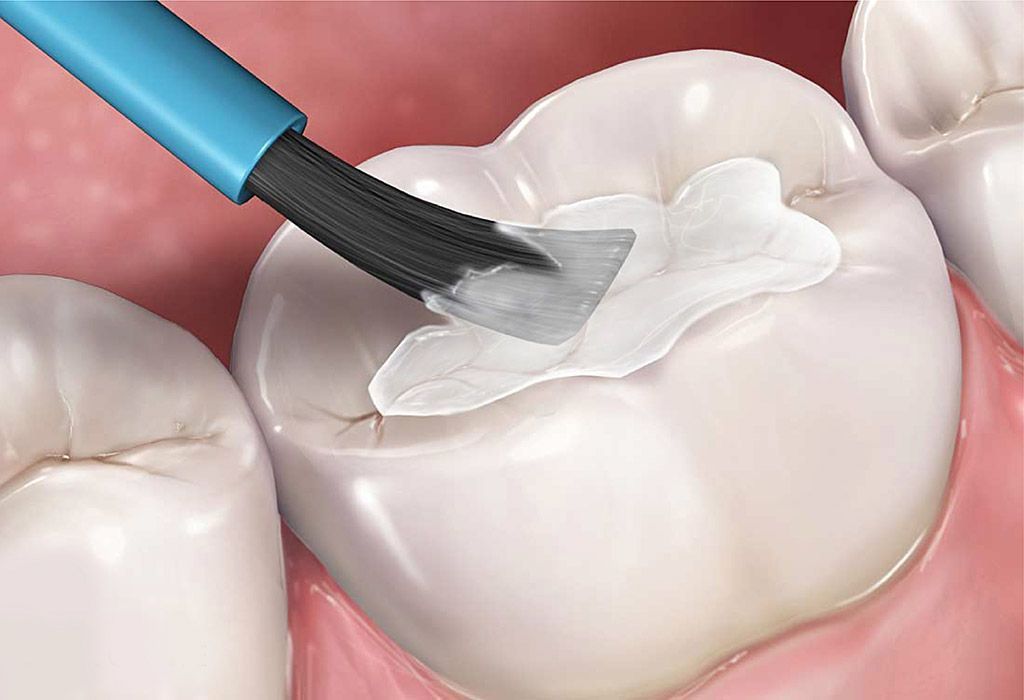 Odontología conservadora en La Sagrera Odontología conservadora en La Sagrera