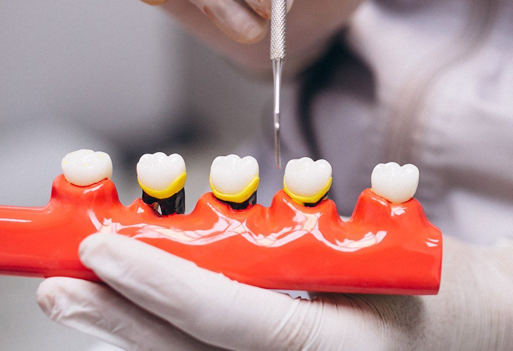 Endodoncia en La Sagrera: fallo de restauraciones dentales anteriores Endodoncia en La Sagrera: fallo de restauraciones dentales anteriores