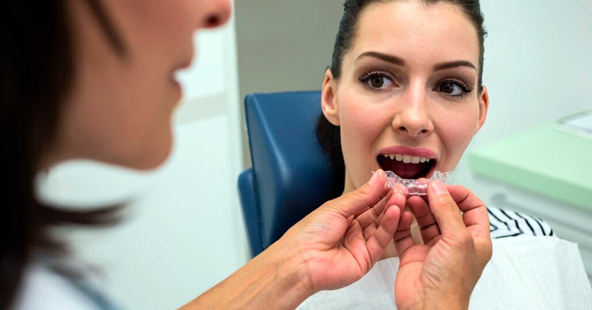Ortodoncia Invisalign Blaudent Ortodoncia Invisalign Blaudent