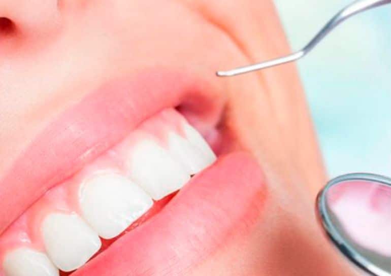 Profilaxis El estadio inicial de la enfermedad de las encías se conoce como gingivitis y, siendo la menos grave, podemos revertirla mediante una limpieza dental profesional exhaustiva. El especialista logrará eliminar la placa dental y los depósitos de sarro ubicados en la superficie del diente y a lo largo de la línea de las encías. Profilaxis El estadio inicial de la enfermedad de las encías se conoce como gingivitis y, siendo la menos grave, podemos revertirla mediante una limpieza dental profesional exhaustiva. El especialista logrará eliminar la placa dental y los depósitos de sarro ubicados en la superficie del diente y a lo largo de la línea de las encías.