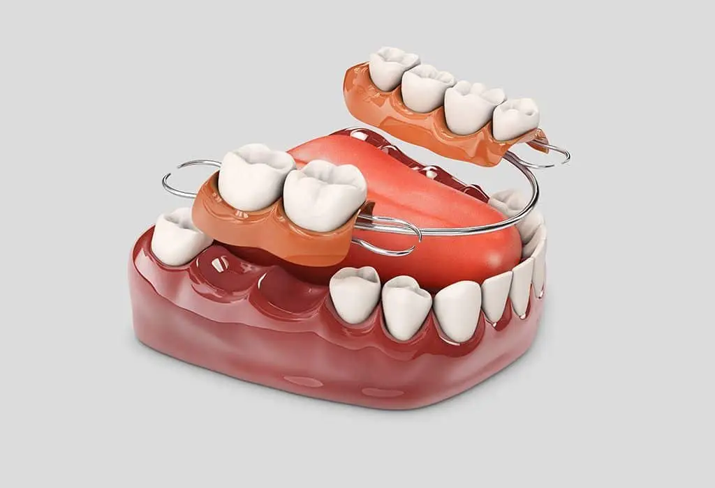 protesis dental mixta en La Sagrera